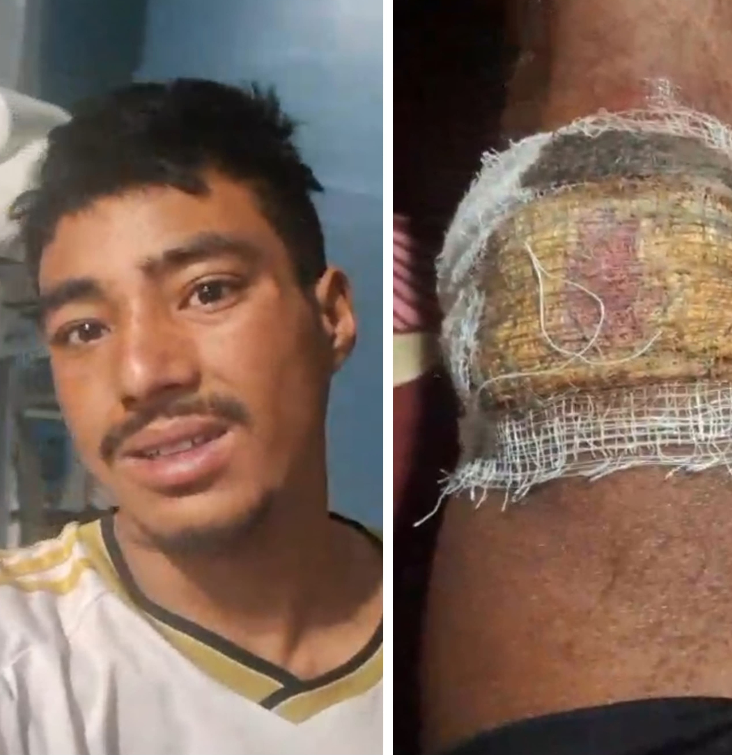 सैनिक कुटपिटको विरोधमा डोल्पामा बिरोध प्रदर्शन, चेकपोष्ट हटाउन माग